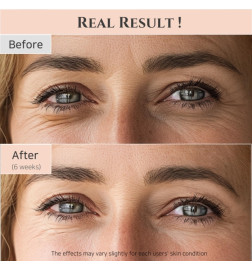 Beauty of Joseon
Paakių serumas nuo raukšlių Revive Eye Serum Ginseng + Retinal 30 ml