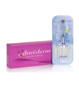 Hialiurono užpildas Juvéderm Ultra Smile 1x0,55ml