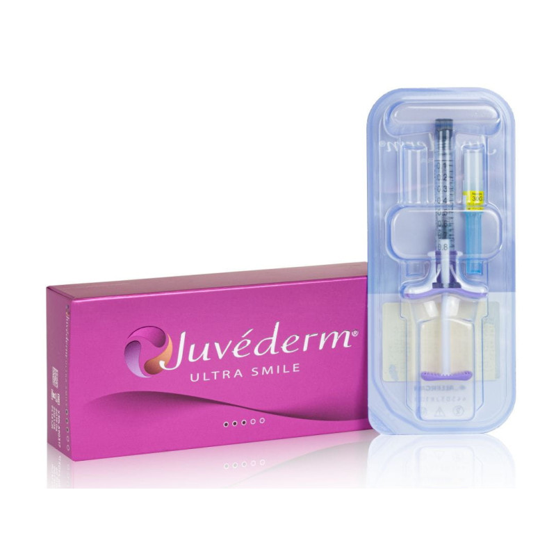 Hialiurono užpildas Juvéderm Ultra Smile 1x0,55ml