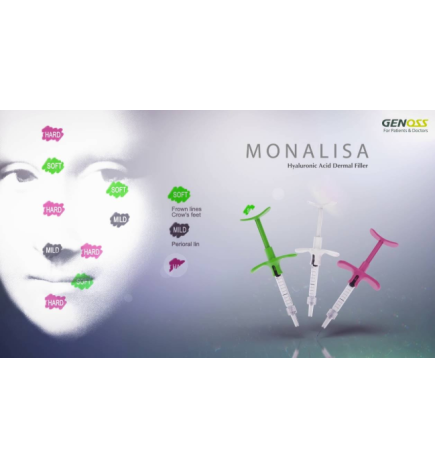 Hialiurono užpildas Monalisa soft su lidokainu 1x1ml